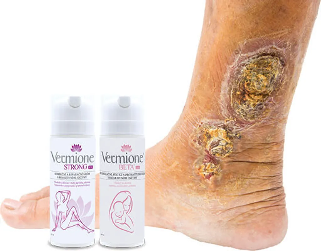 Vermione - PACCHETTO DI CURA RINNOVANTE PER LA BELLEZZA XXL