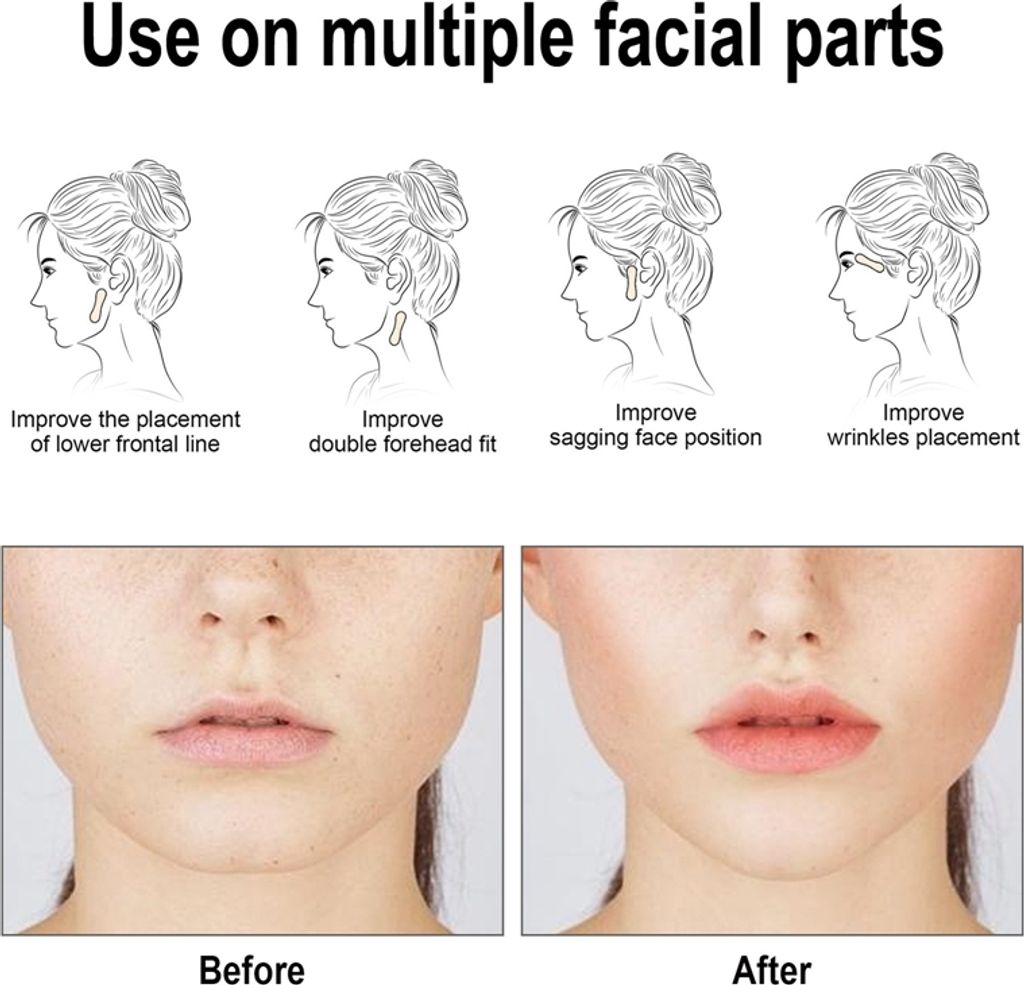120 Stück Face Lift Patch V Gesicht Atmungsaktiv Unsichtbar Produktbild 6