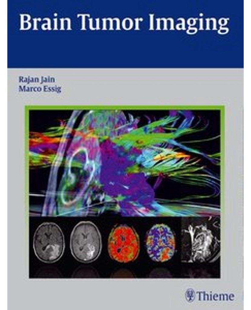 Brain Tumor Imaging