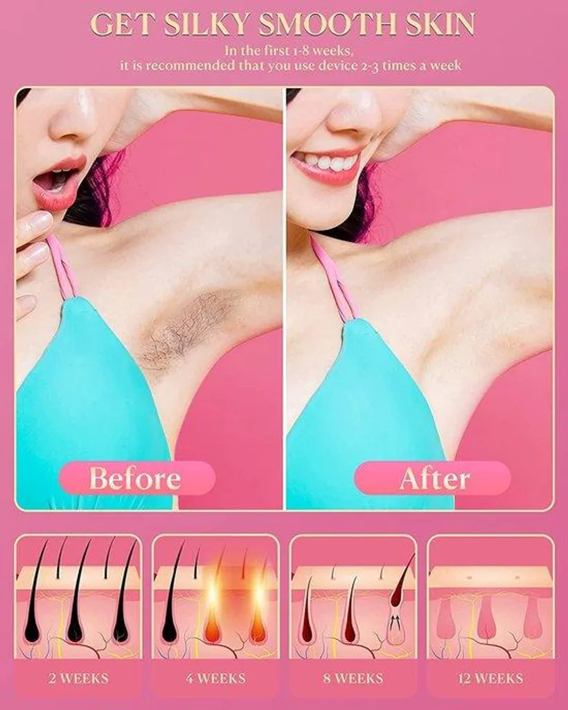 Épilateur IPL visage et corps 999 999 flashs anti-rides