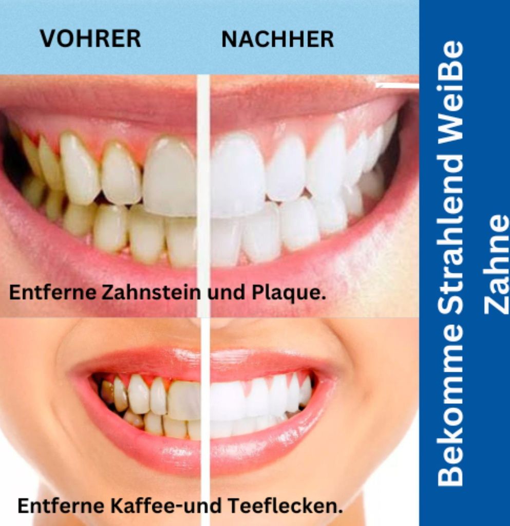 Zahnpflege-Set 4er Set für Zahnreinigung Zahnsteinentferner Produktbild 2
