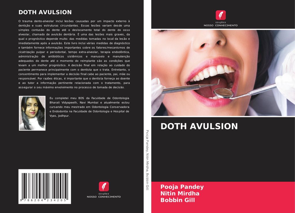 Doth Avulsion