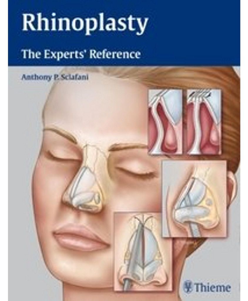 Rhinoplasty