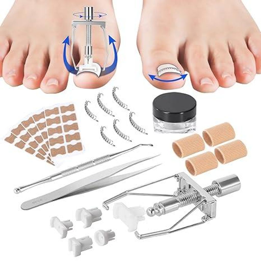 Eingewachsener Zehennagel Behandlungskit, eingewachsener Zehennagel Kit mit eingewachsener Zehennagel Orthesen und