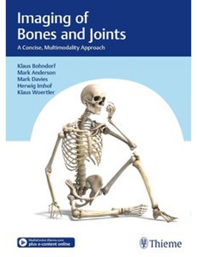 Imaging of Bones and Joints