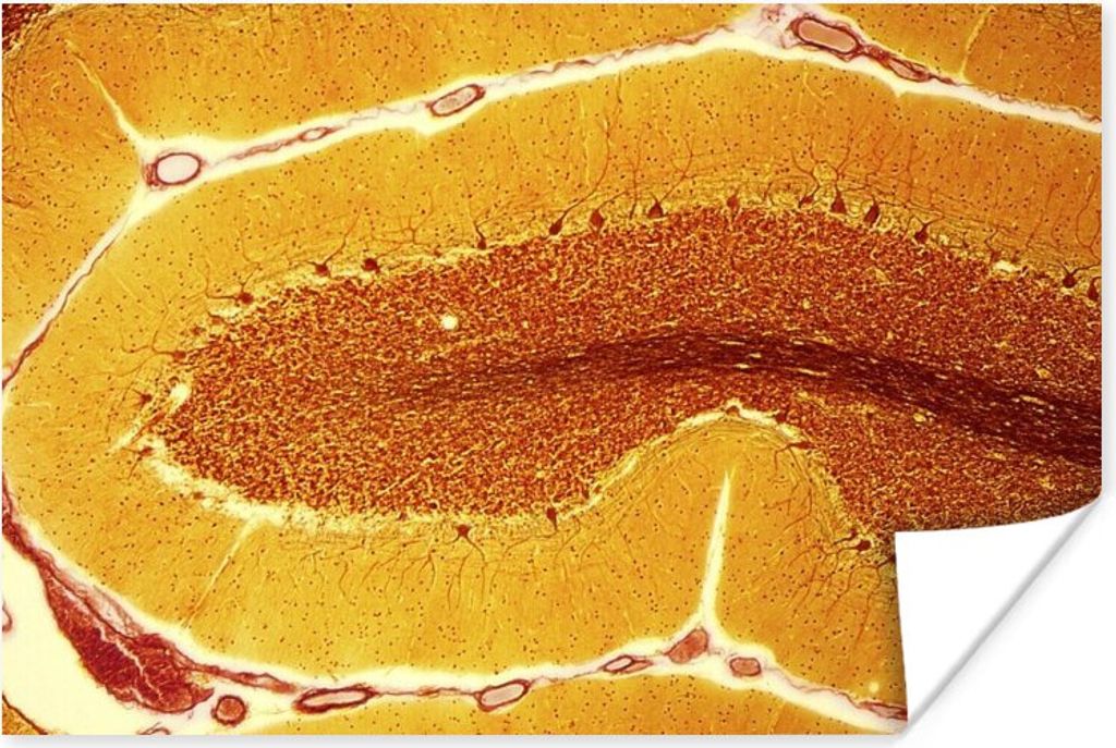 MuchoWow Poster Orangefarbene Zellen in einem Nerv 120x80 cm - Bilder