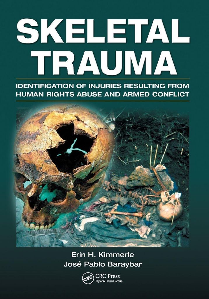 Skeletal Trauma