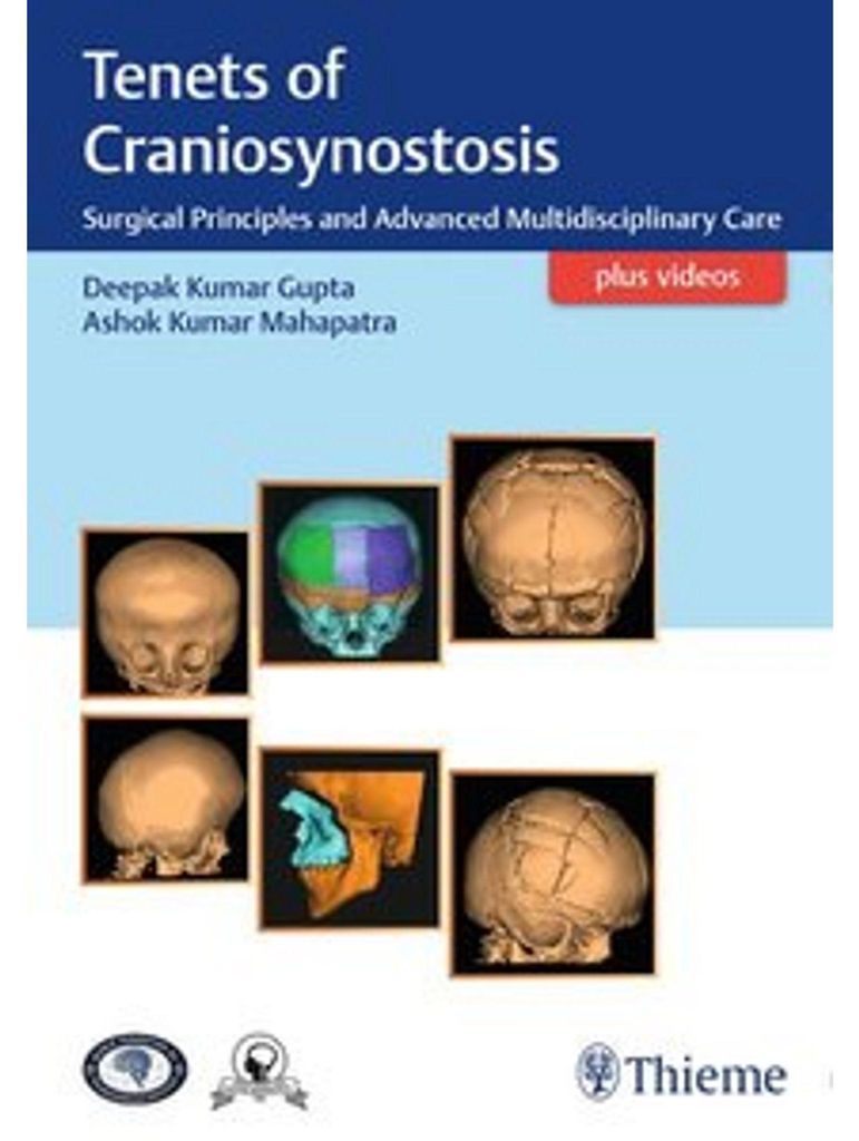 Tenets of Craniosynostosis