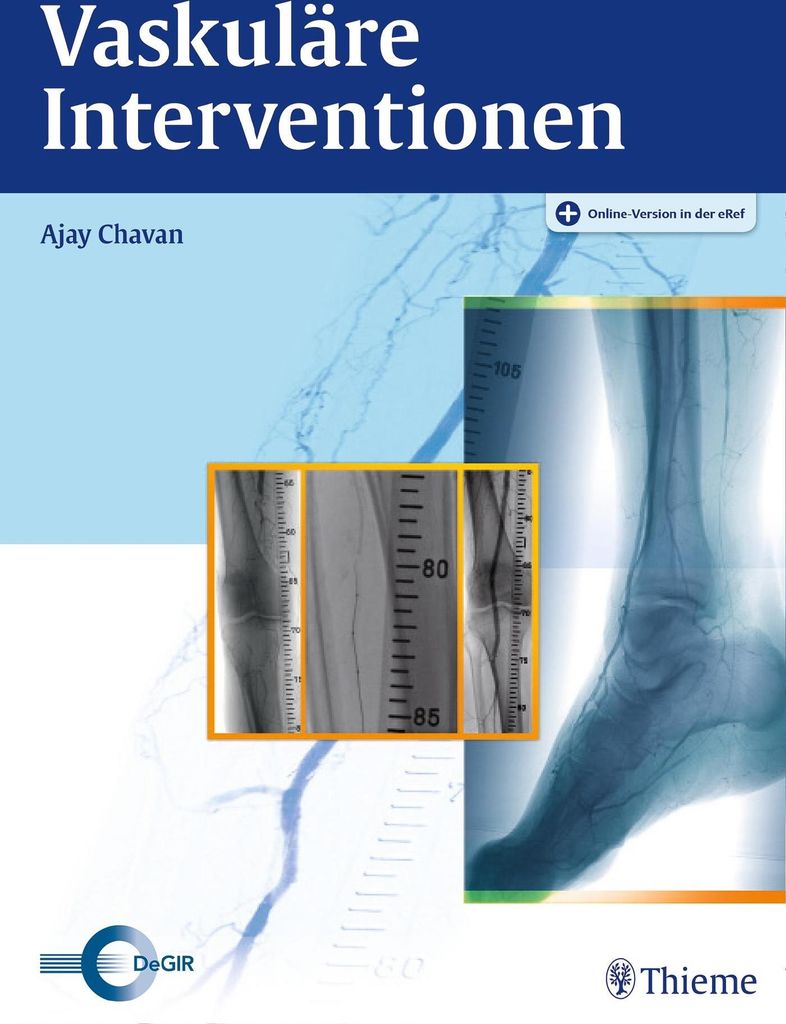 Vaskuläre Interventionen