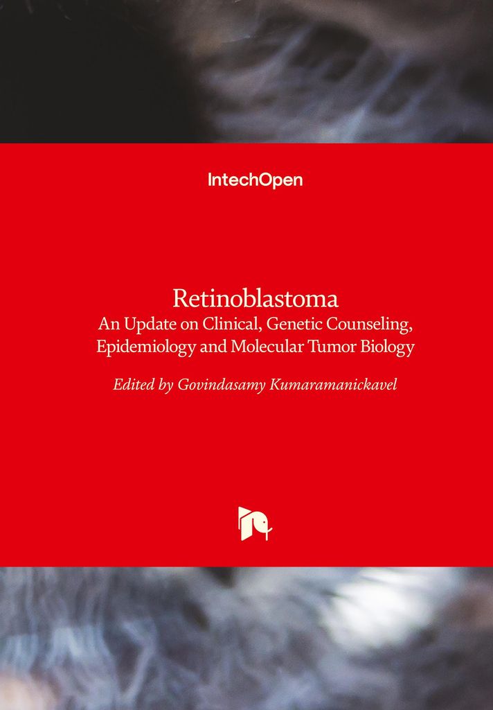Retinoblastoma