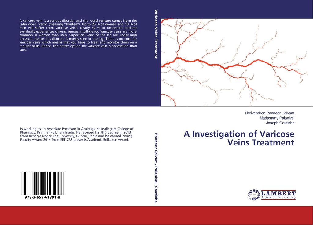 A Investigation of Varicose Veins Treatment