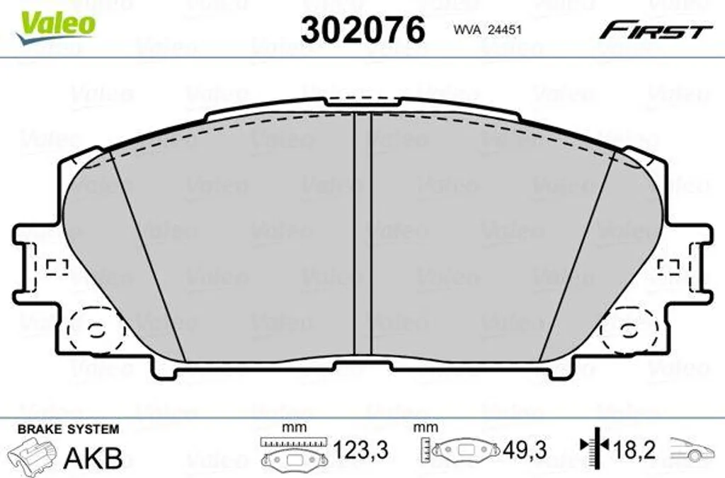 Fini les bruits de freinage : Plaquettes VALEO 302076 pour Toyota Yaris