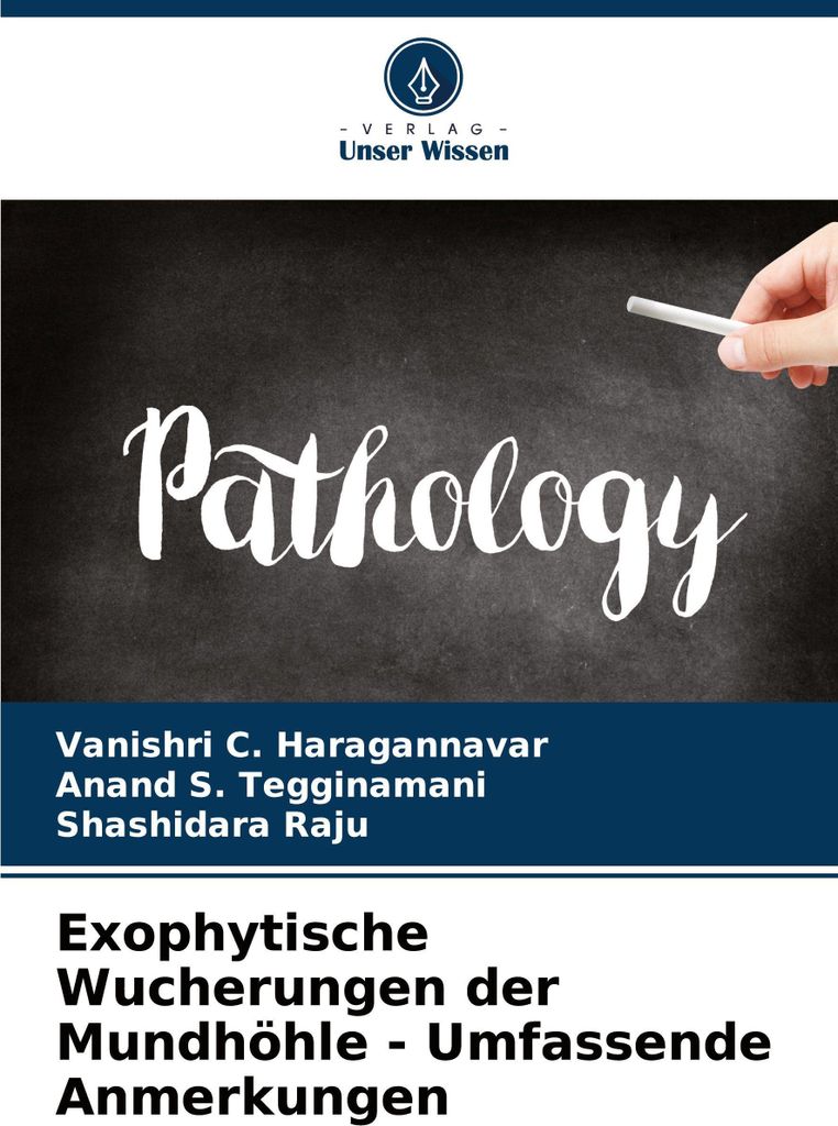 Exophytische Wucherungen der Mundhöhle - Umfassende Anmerkungen