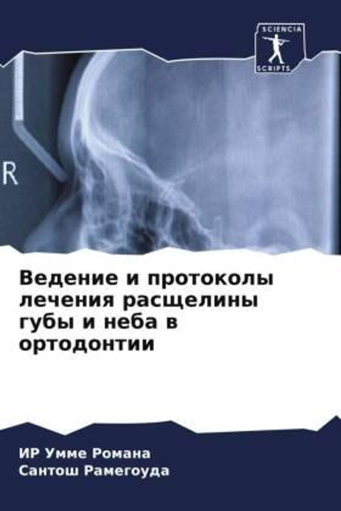 Vedenie i protokoly lecheniq rasscheliny guby i neba w ortodontii