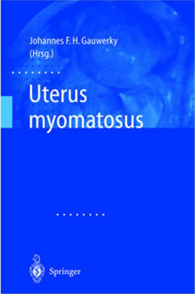 Uterus myomatosus