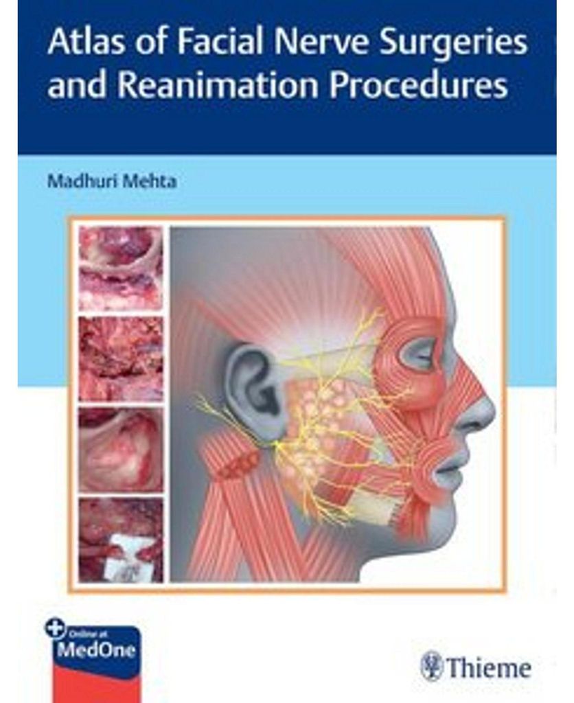 Atlas of Facial Nerve Surgeries and Reanimation Procedures