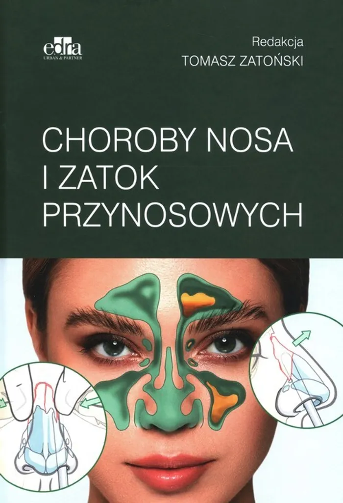 Soigner les sinusites : manuel Choroby nosa i zatok przynosowych polonais