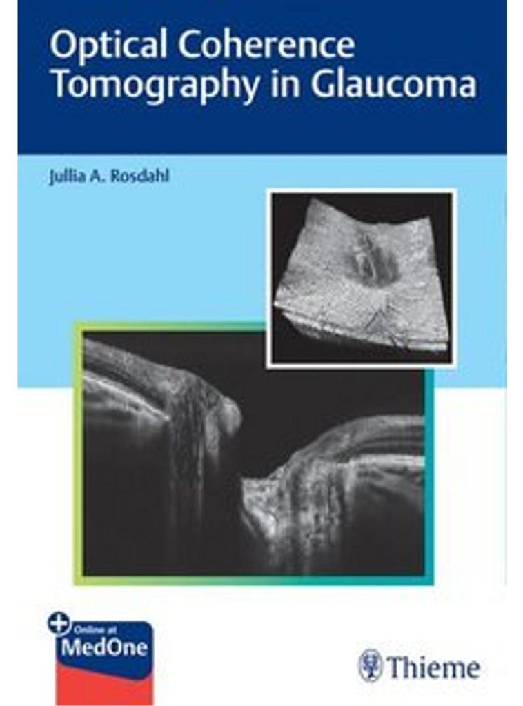 Optical Coherence Tomography in Glaucoma