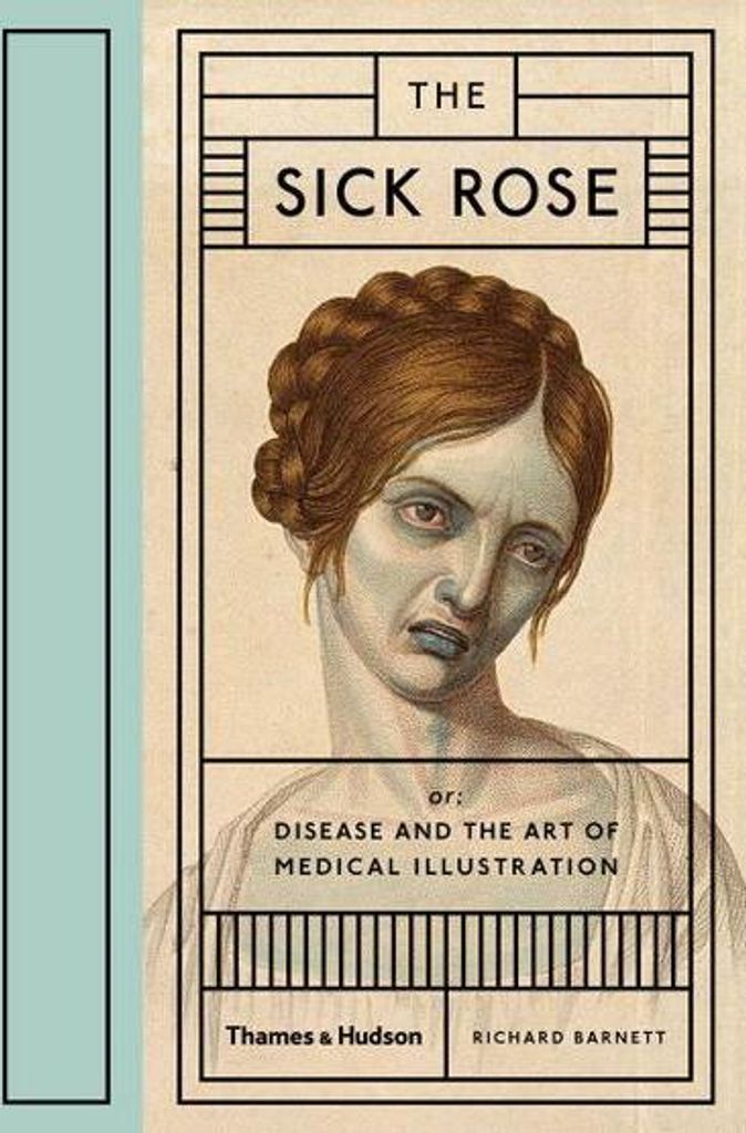 The Sick Rose