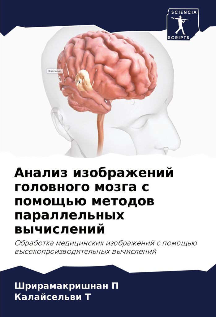 Analiz izobrazhenij golownogo mozga s pomosch'ü metodow parallel'nyh wychislenij