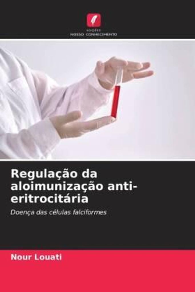 Regulação da aloimunização anti-eritrocitária