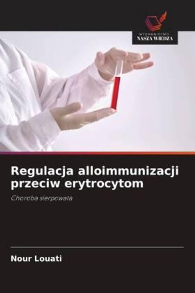 Regulacja alloimmunizacji przeciw erytrocytom
