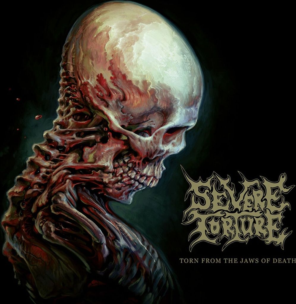 Severe Torture: Torn From The Jaws Of Death