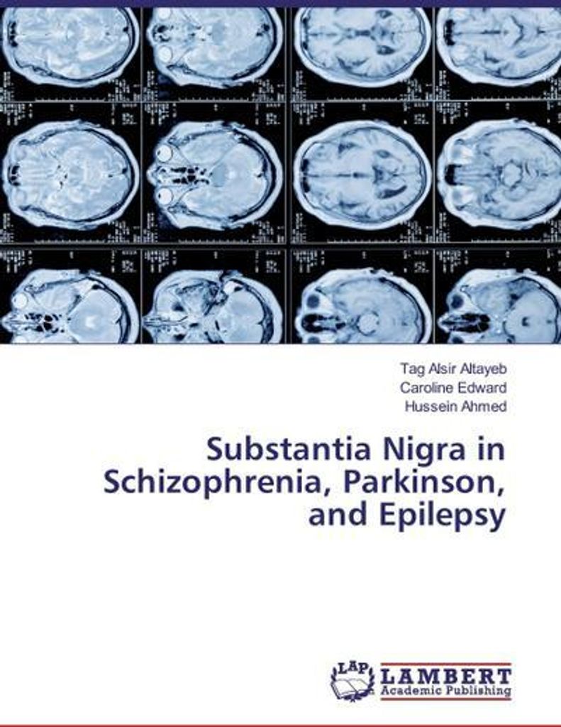 Substantia Nigra in Schizophrenia, Parkinson, and Epilepsy