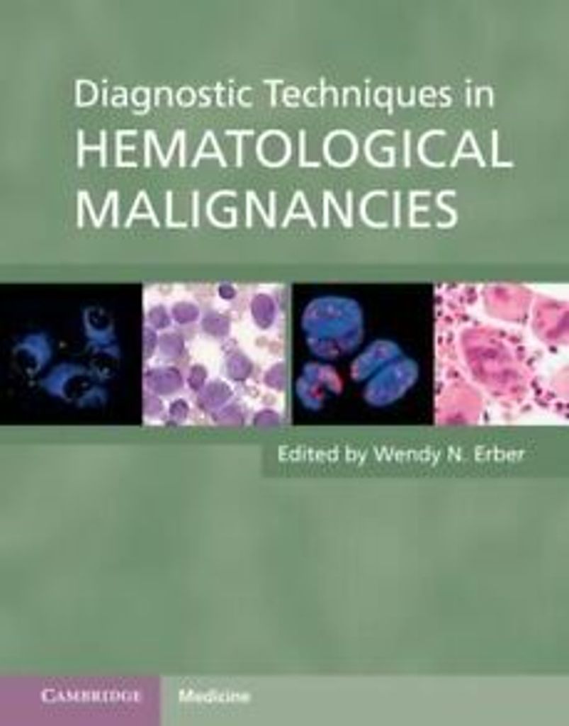Diagnostic Techniques in Hematological Malignancies