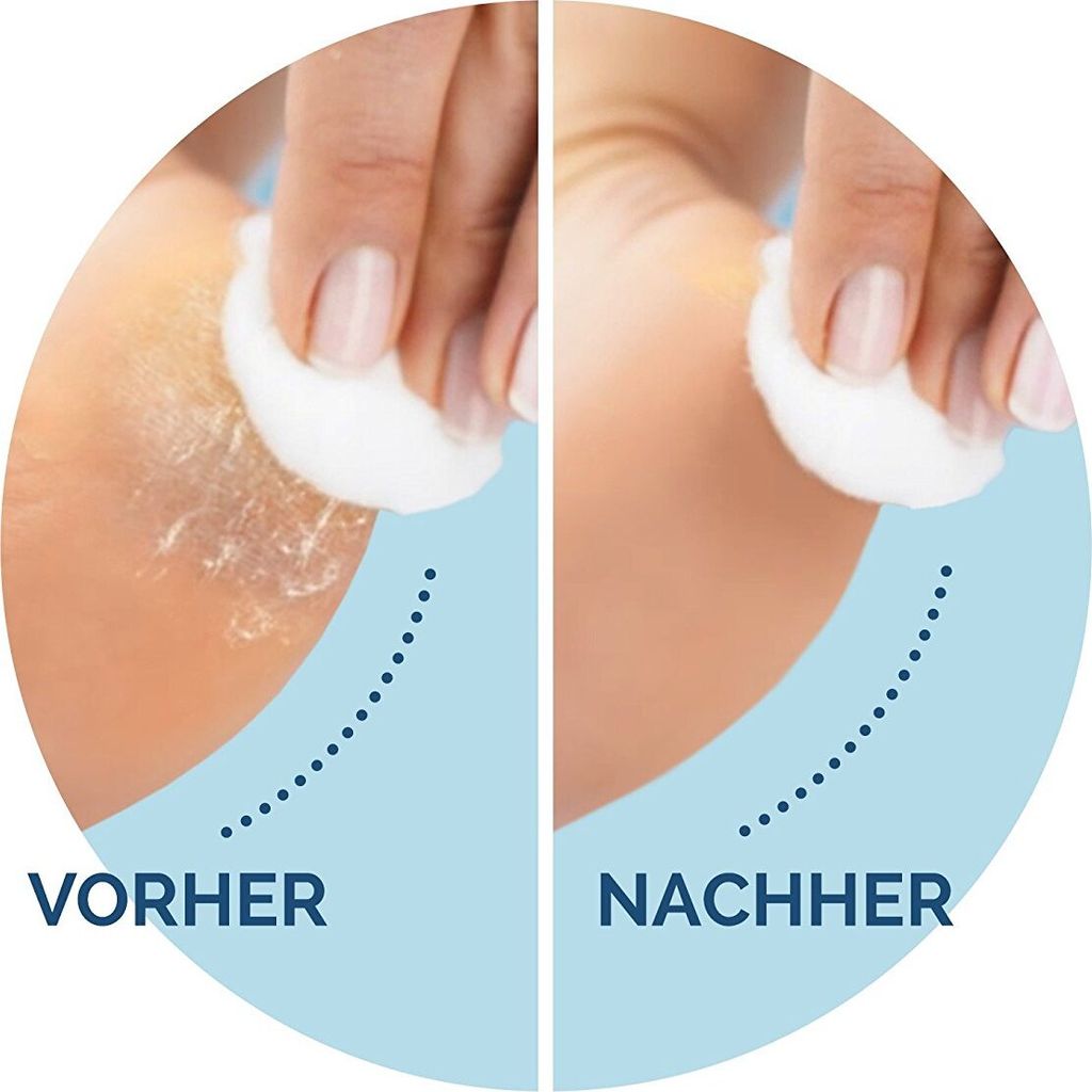 Scholl Velvet Express Pedi zmywacz do zrogowaceń w kolorze Zdjęcie produktu 13
