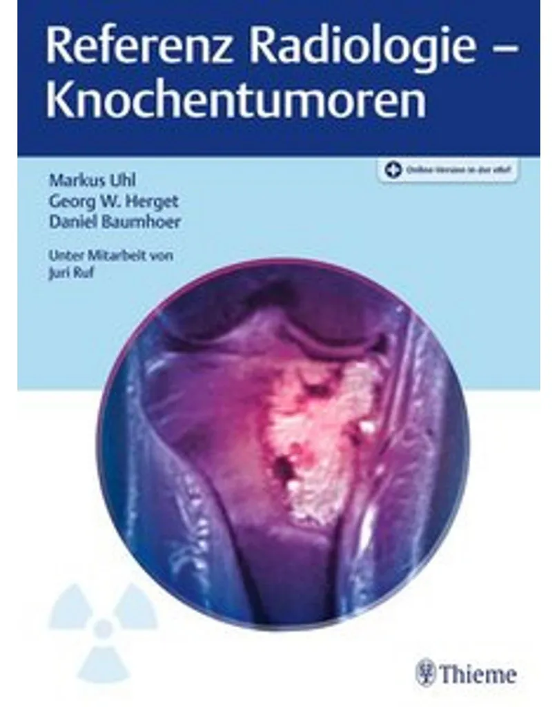 Aide au Diagnostic des Tumeurs Osseuses pour Radiologues et Internes