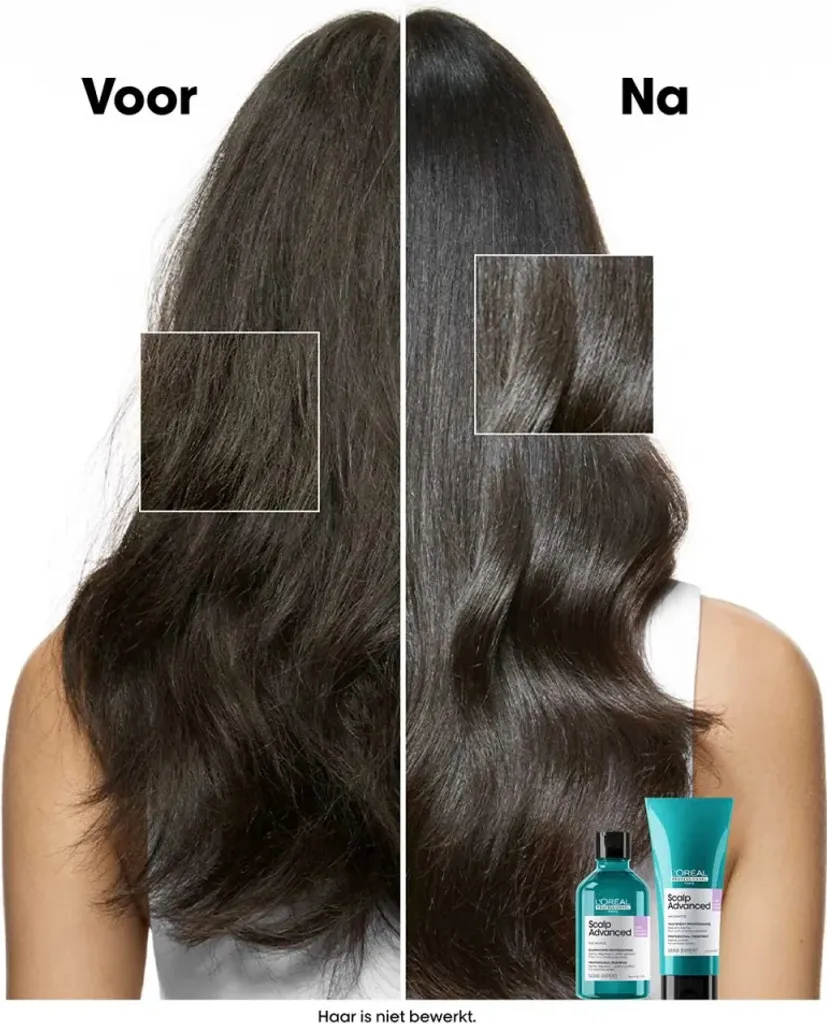 L'Oréal Serie Expert Scalp Advanced 500ml: Spa per la tua Cute - 5