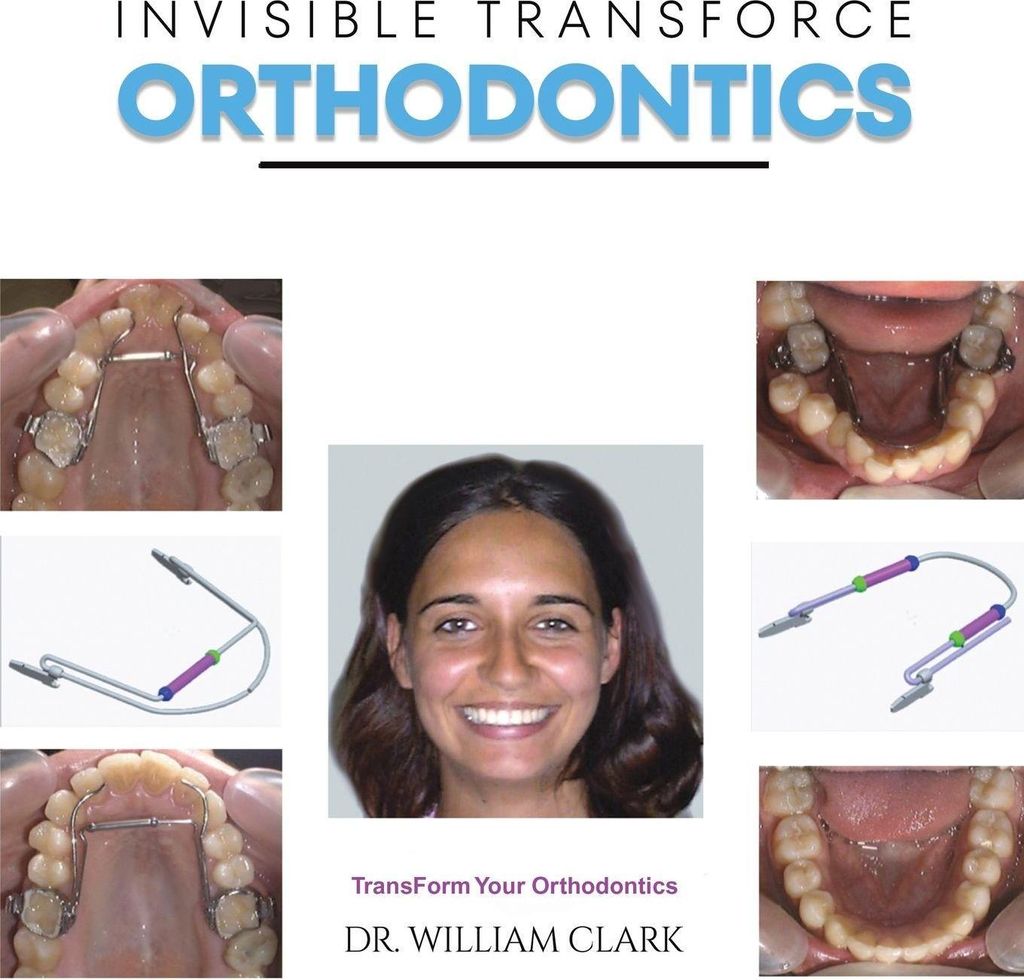 Invisible Transforce Orthodontics – Lingua: Inglese
