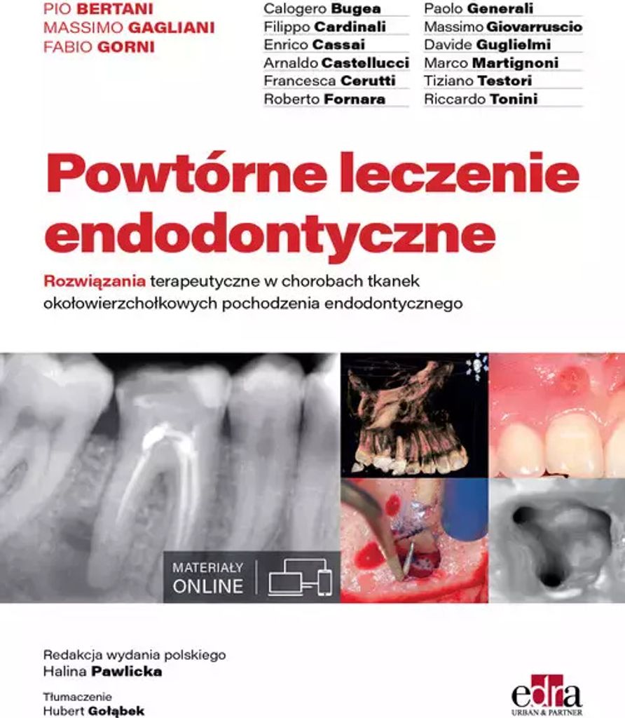 Powtórne leczenie endodontyczne (Buch auf Polnisch)