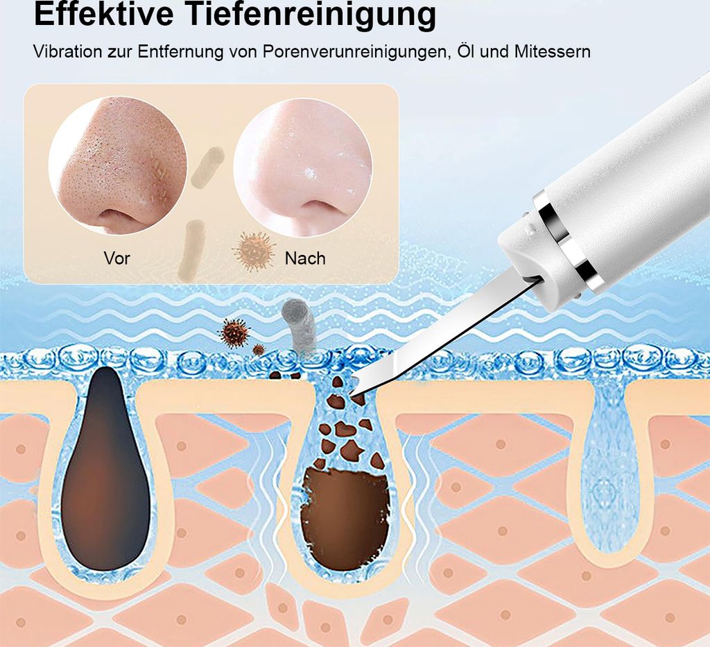 Ultraschallpeelinggerät Skin Scrubber für Tiefenreinigung, Produktbild 6