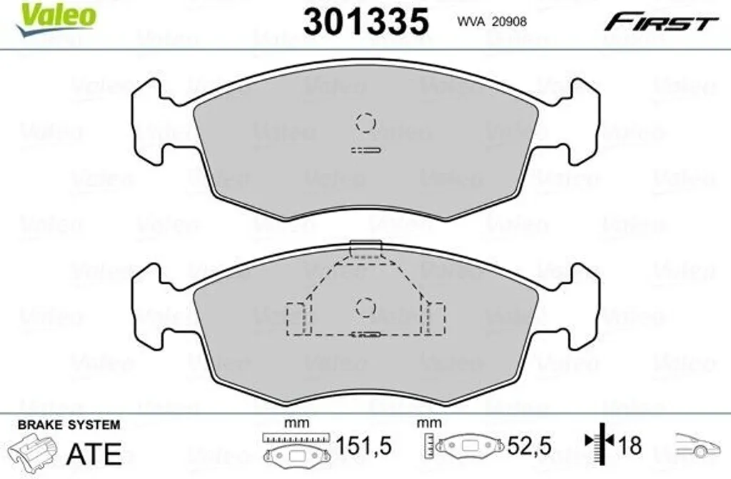 Plaquettes de frein avant Valeo 301335 : Stop aux sifflements sur Ford