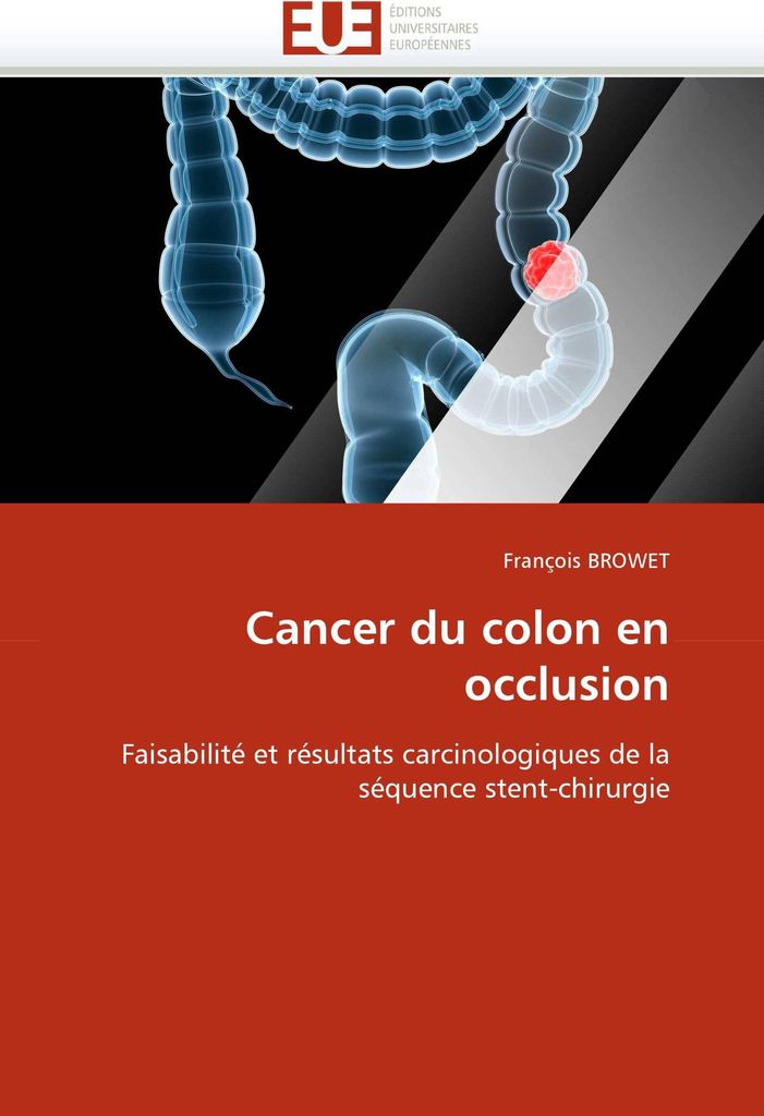 Cancer du colon en occlusion