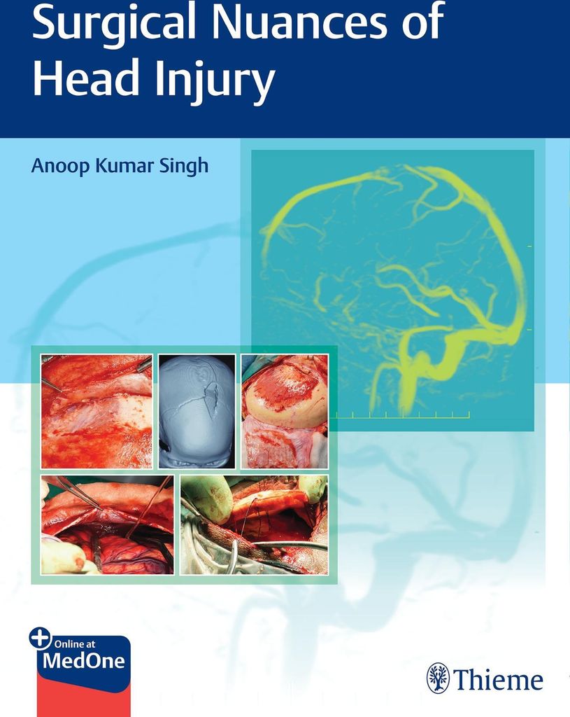 Surgical Nuances of Head Injury