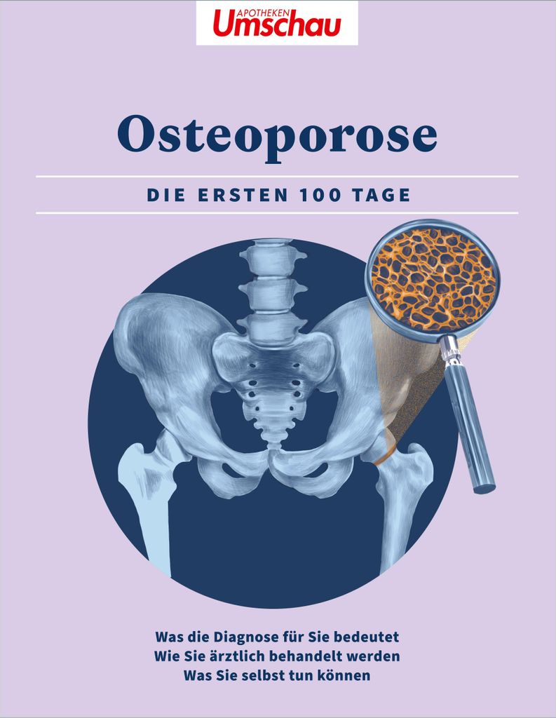 Apotheken Umschau: Osteoporose