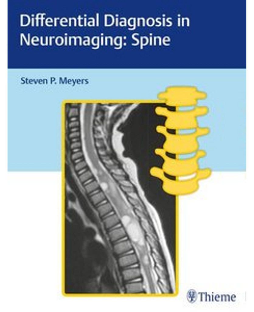 Differential Diagnosis in Neuroimaging