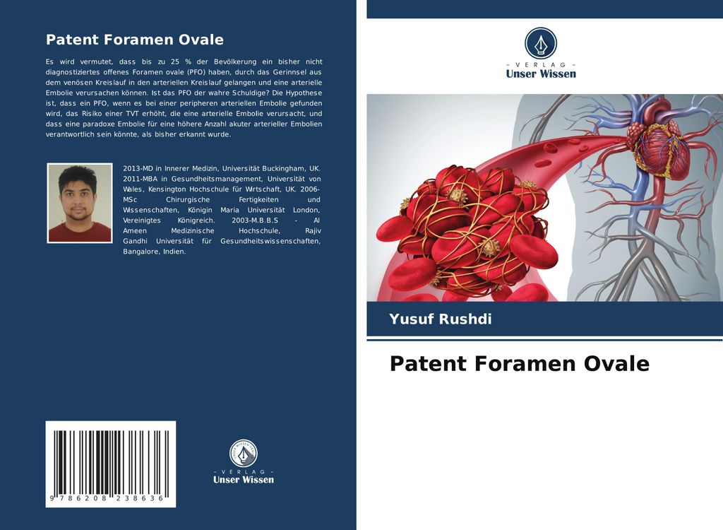 Patent Foramen Ovale