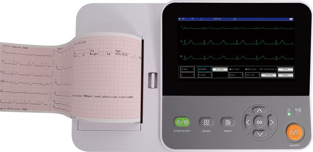 E6 Tragbares 12-Kanal-EKG-Gerät Elektrokardiograph mit Drucker 6-Kanal 7" Touchscreen Softkey PC Software Interpretation 6 Channel 12 Lead ECG Mac...