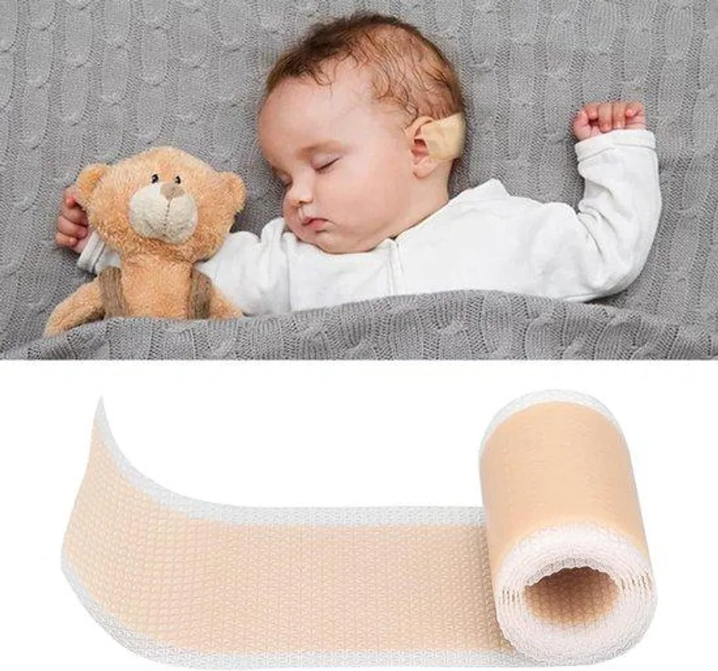 Correcteur silicone pour oreilles décollées bébé - Protection invisible