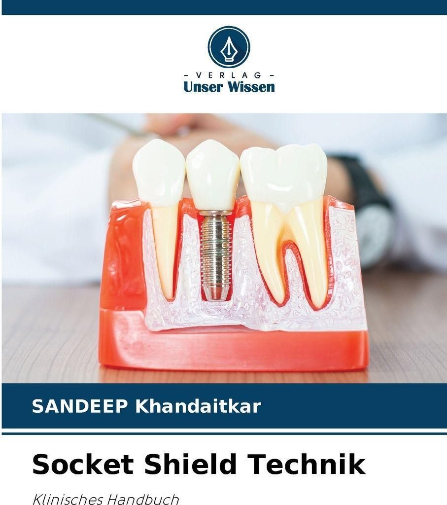 Socket Shield Technik