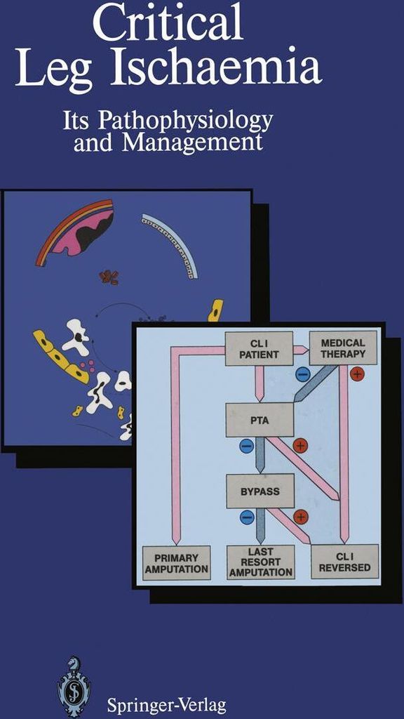 Critical Leg Ischaemia