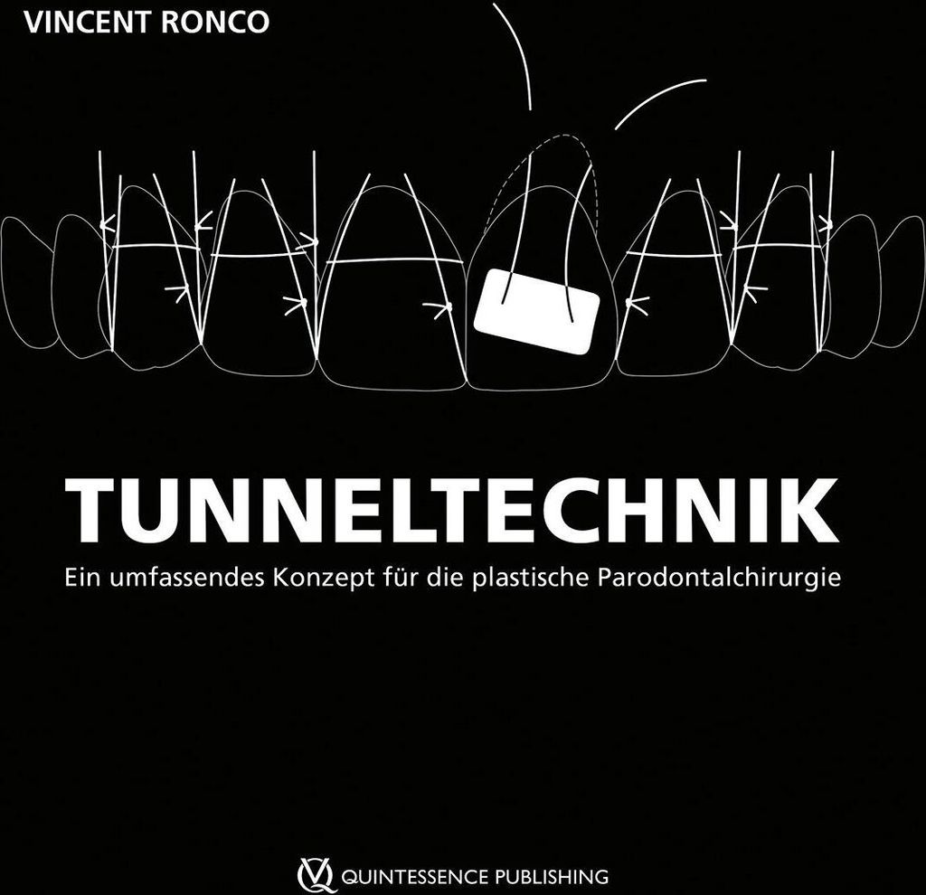 Tunneltechnik