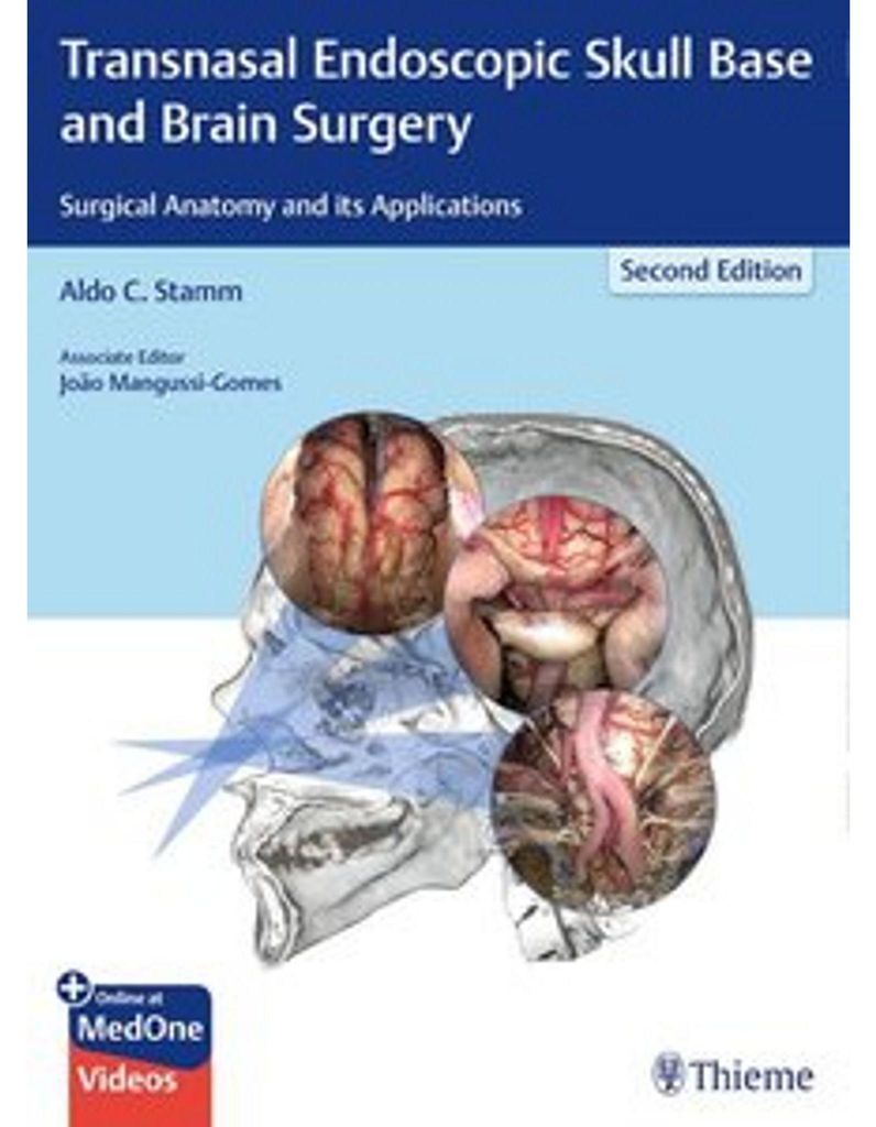Transnasal Endoscopic Skull Base and Brain Surgery