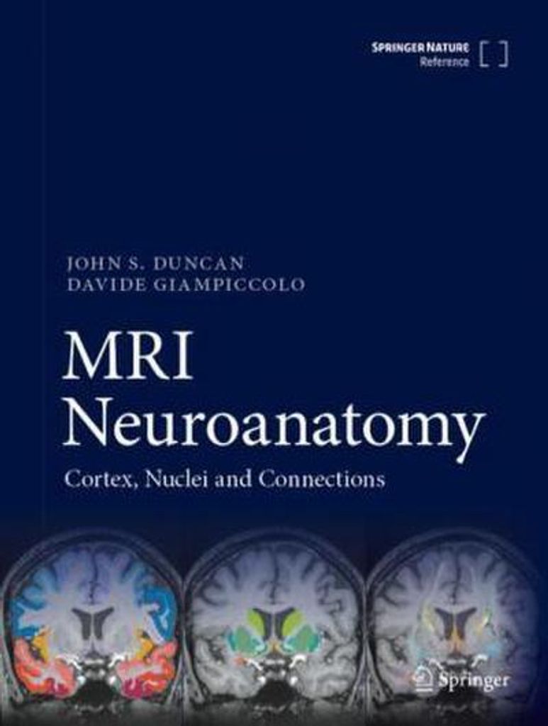 MRI Neuroanatomy