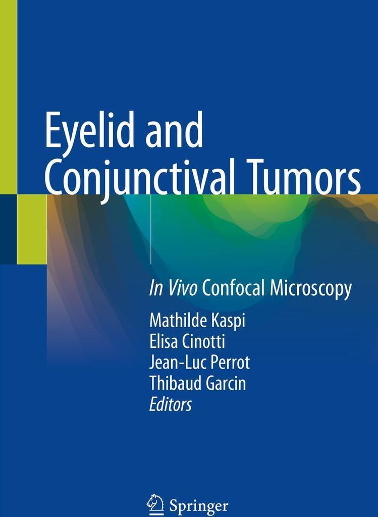 Eyelid and Conjunctival Tumors