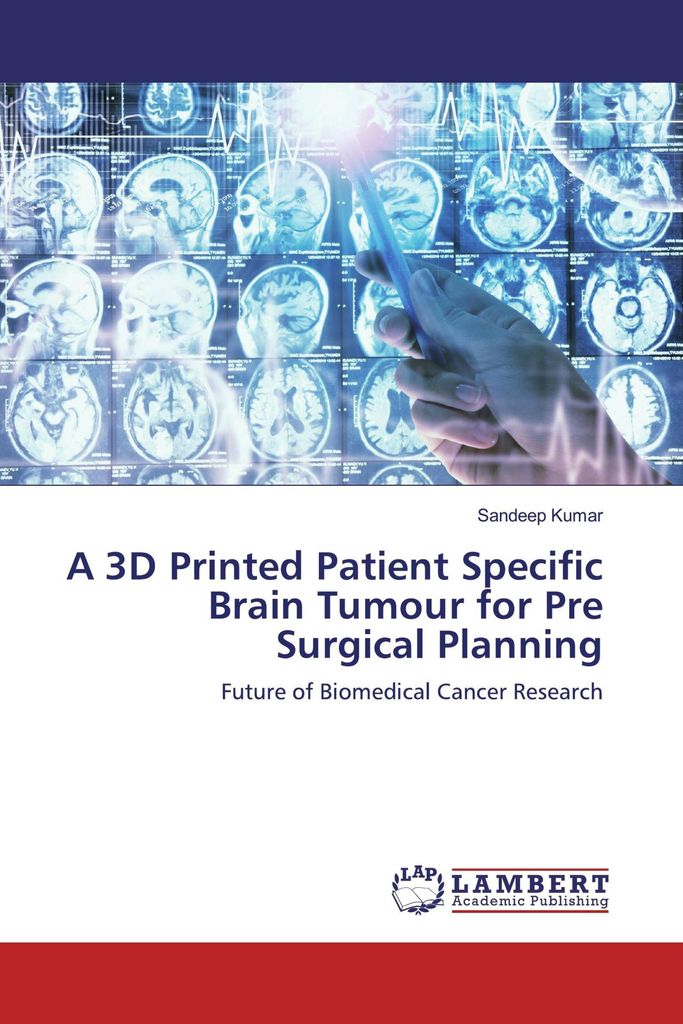 A 3D Printed Patient Specific Brain Tumour for Pre Surgical Planning